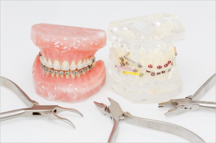 Orthodontics-image.jpg